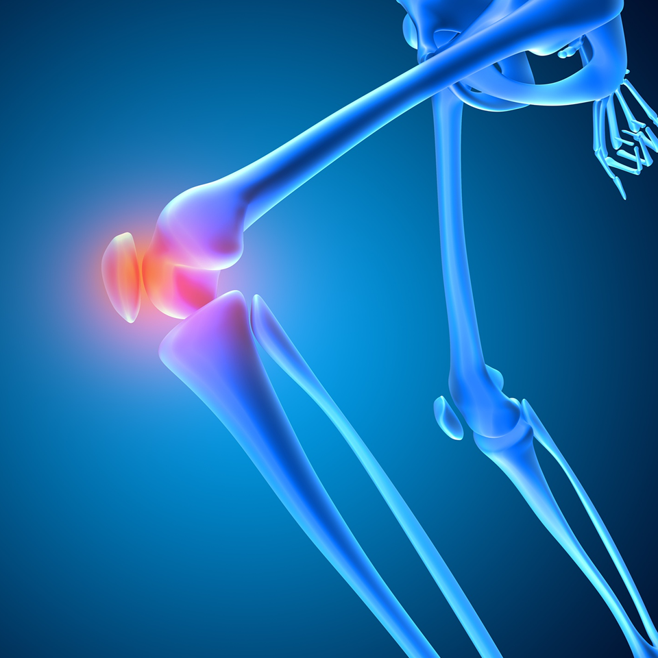 high tibial osteotomy