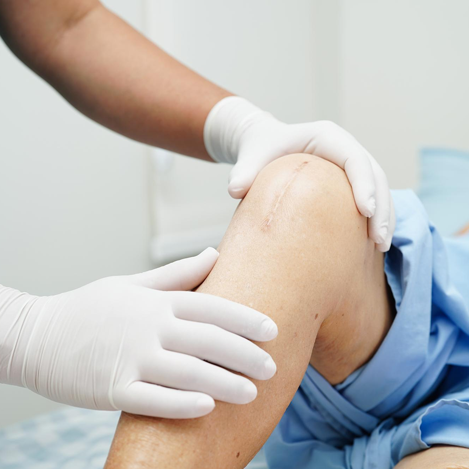 Multi-ligament knee injury