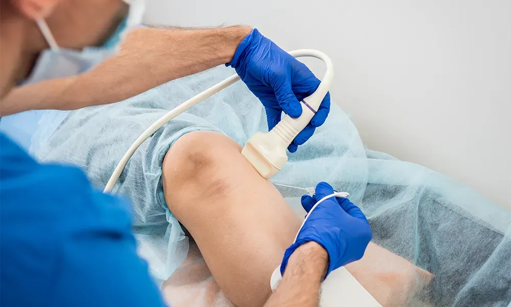 Non-Surgical Knee Pain Treatment , cryoablation for knee pain