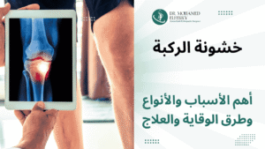 خشونة الركبة التشخيص والأعراض والأسباب