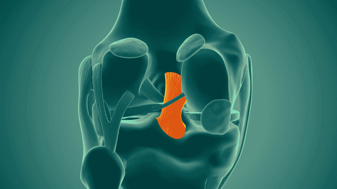 القطع في الرباط الصليبي