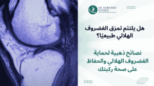 هل يلتئم تمزق الغضروف الهلالي طبيعيًا