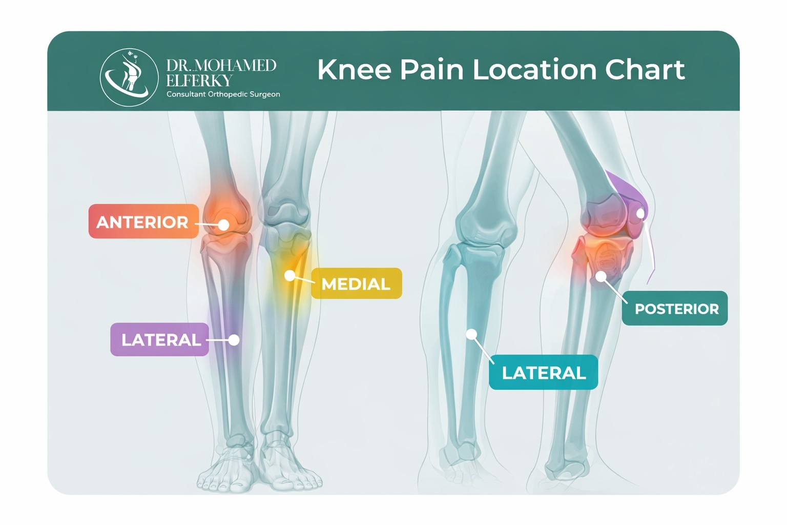 Knee Pain Location Chart: What Your Pain Location Means & Causes
