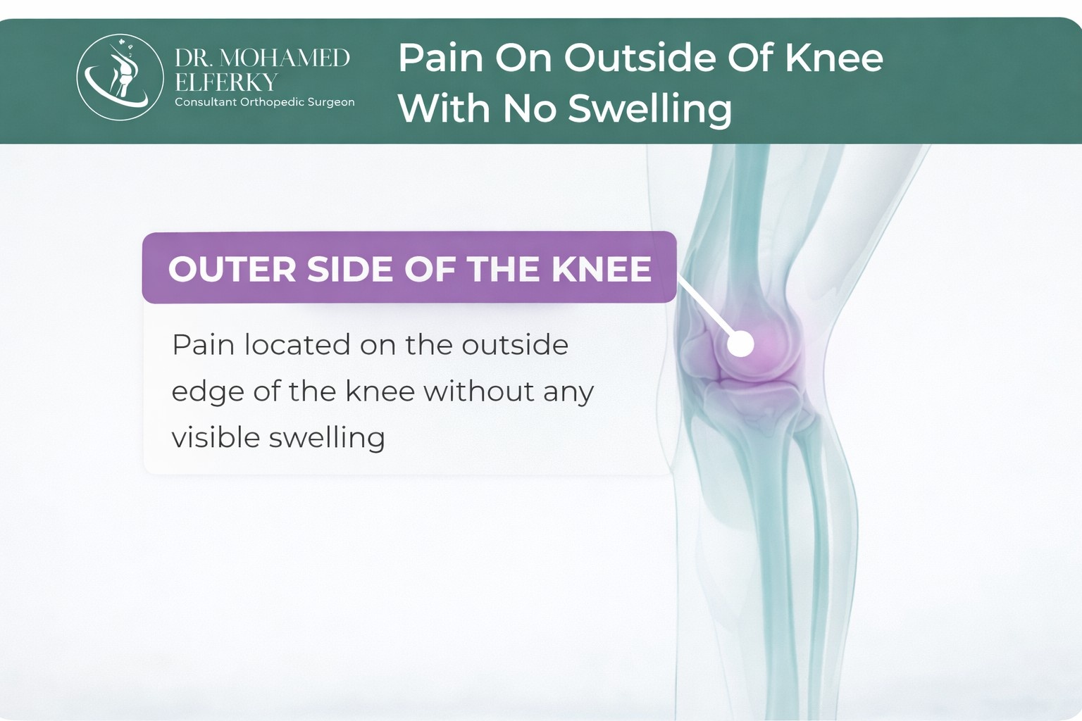 Pain On Outside Of Knee With No Swelling