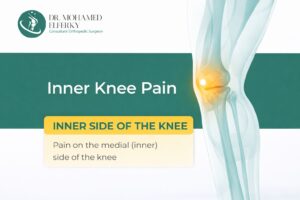 inner knee pain